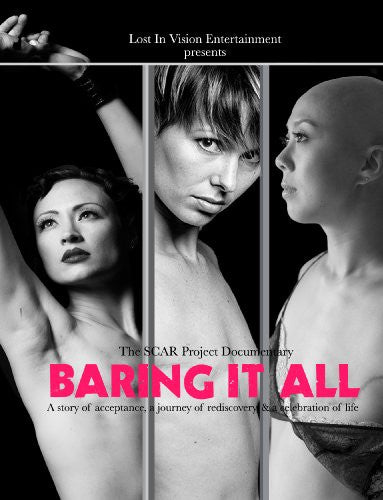 Baring It All (The SCAR Project documentary)