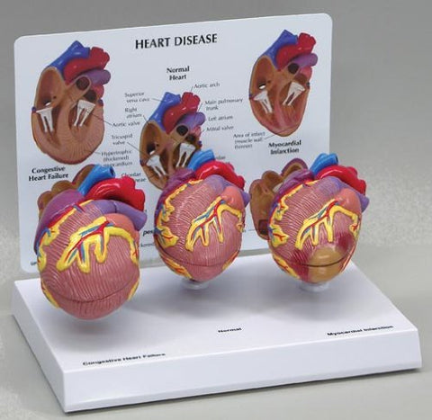 3 Piece Mini Heart Anatomy Models Set