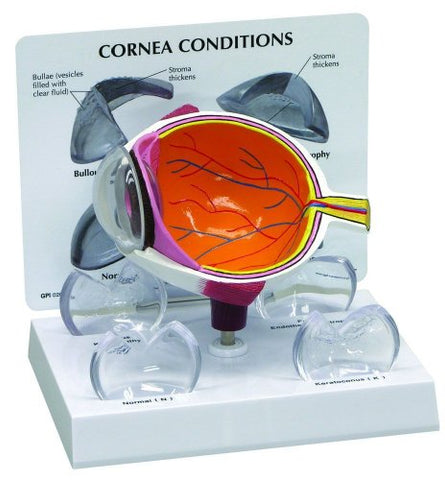 Cornea Cross Section Eye Anatomy Model